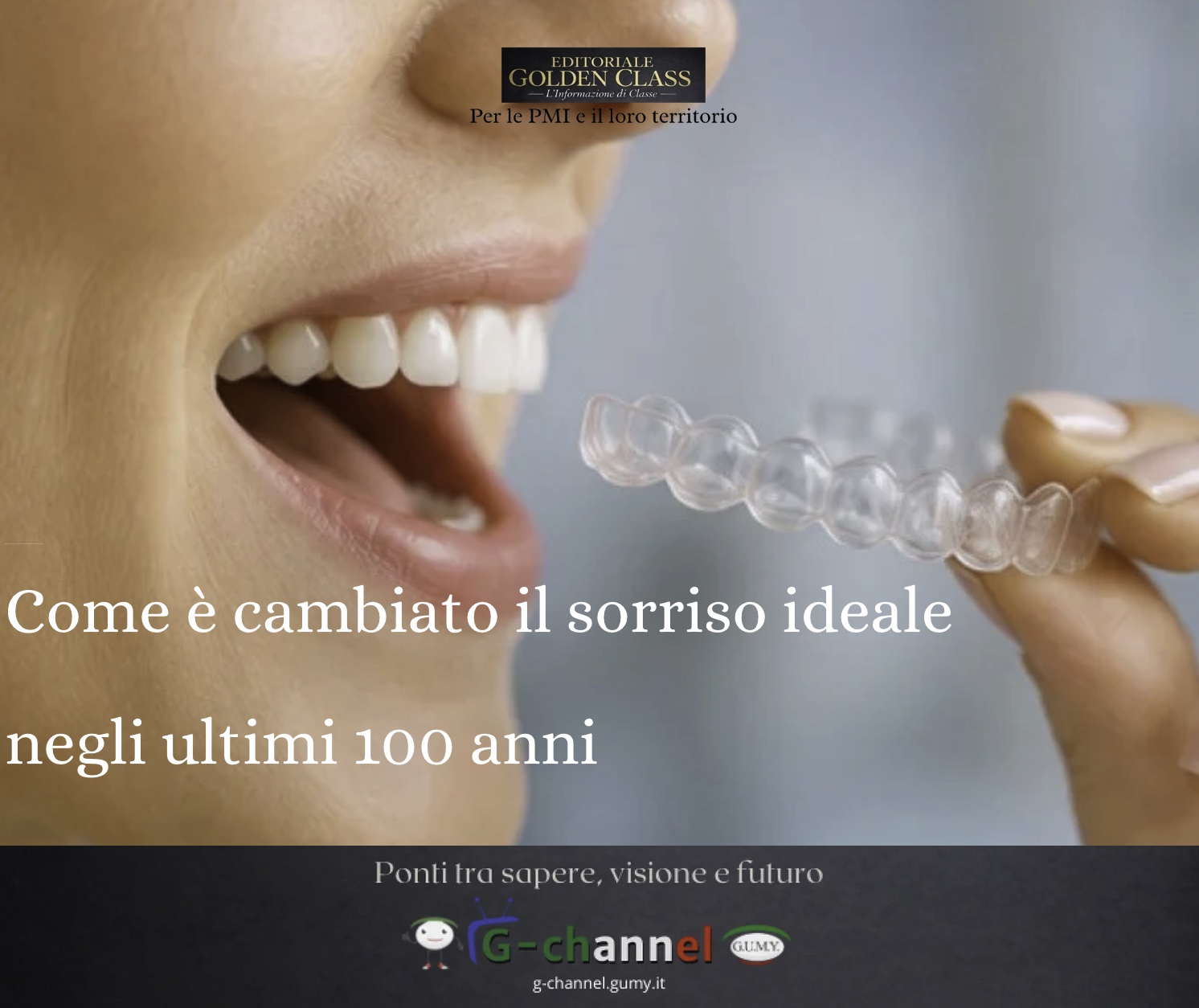 Come è cambiato il sorriso ideale negli ultimi 100 anni